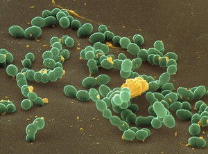 Streptococcus mutans