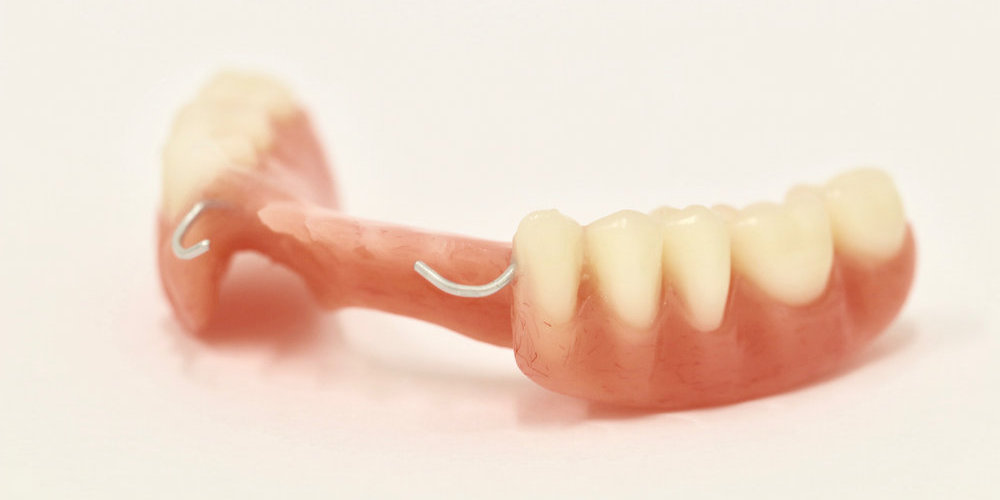 акриловые зубные протезы