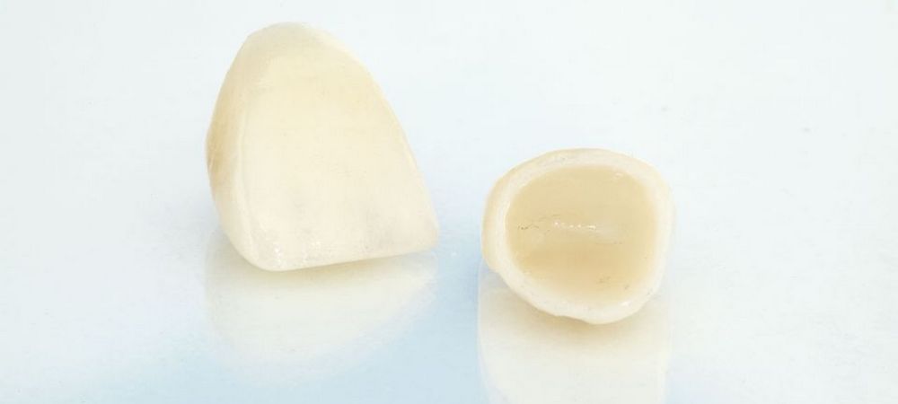 кераммические зубные коронки