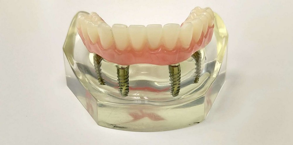 из каких материалов производится зубной протез